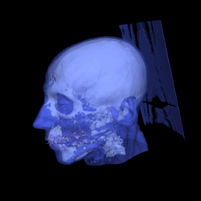 Deep Learning-Based Viewpoint Recommendation in Volume Visualization preview